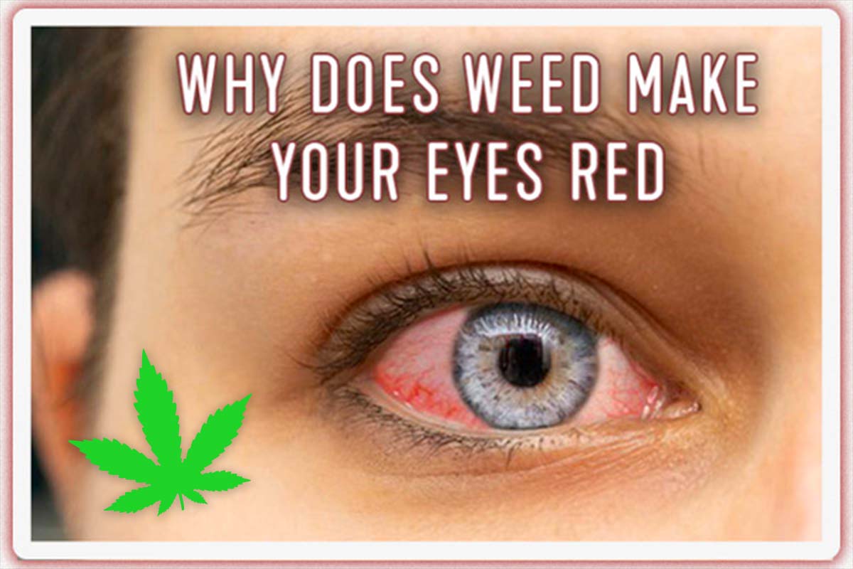 why-does-weed-make-your-eyes-red